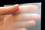 Detalles
